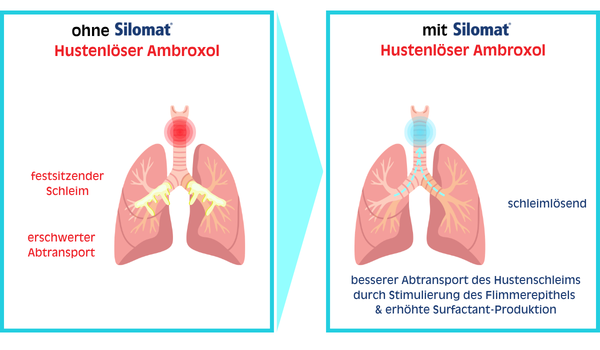 Ambroxol Wirkungsillustration Ambroxol Wirkungsillustration