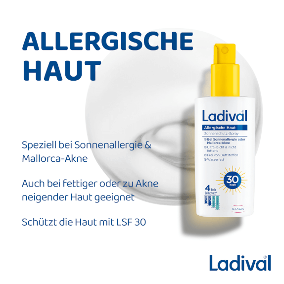 Speziell bei Sonnenallergie und Mallorca-Akne