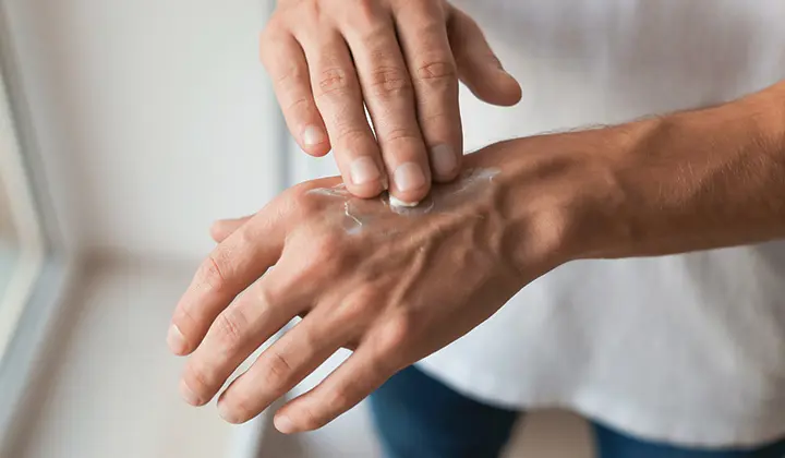 Dermatitis als Hautentzündung