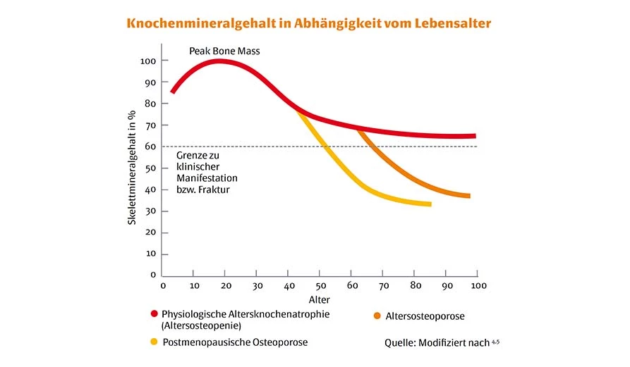 Knochenmineralgehalt 