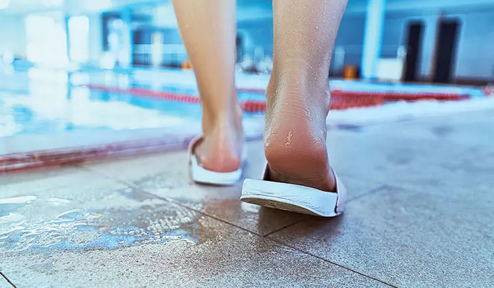 Hautpilz durch mangelnde Hygiene